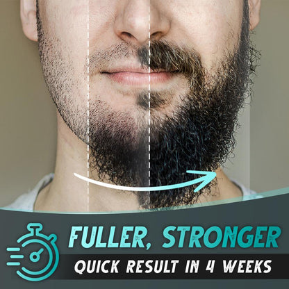 Beard Growth Roller Set